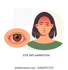 Eye Inflammation due to Infection - Pink Eye - Stock Illustration as EPS 10 File