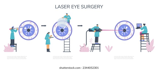 Cartel infográfico con médicos del diagrama de procedimientos de cirugía láser ocular. Diseño de pancartas infográficas para cirugía de láser ocular o cirugía de lasik para clínicas, ilustración vectorial plana.
