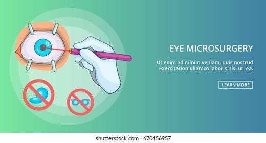 Eye microsurgery horizontal concept. Cartoon illustration of eye microsurgery banner horizontal vector for web