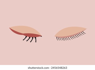 Eye Problem concept. Demodex Face mite infestation or Inflammation. Editable Clip Art.