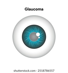 Defeito da estrutura ocular do olho Glaucoma