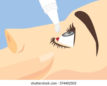 Eye treatment with eye drops for Redness, Dry Eyes, Allergy and Eye Itching.
