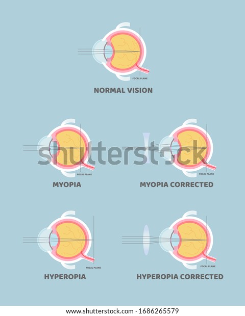 Eyeball Anatomy Internal Organs Body Part Stock Vector (Royalty Free ...