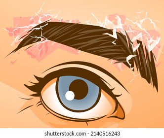 The Eyebrow Dandruff. Skin Problems. Allergy And Dry Skin. Healthcare Illustration. Vector Illustration. 