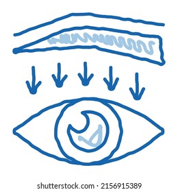 vectores de icono de boceto quirúrgico hacia abajo. Mano dibujó la línea azul del doodle ceja hacia abajo el signo de la cirugía. ilustración de símbolo aislado