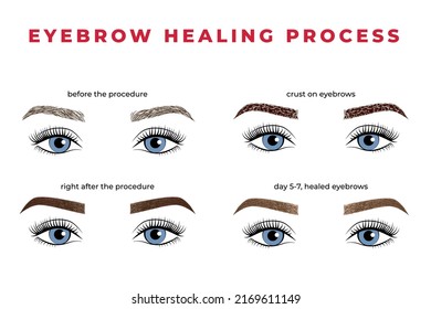 The eyebrow healing process after permanent makeup. Illustration brows with eyes