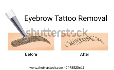 Eyebrow Tattoo Removal, Before and After Results, Vector Illustration