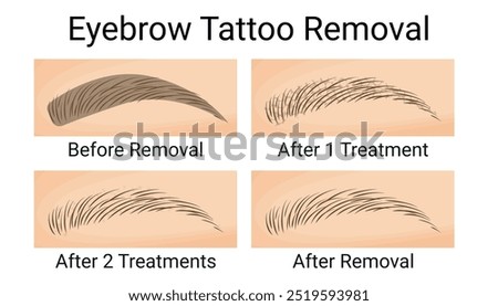Eyebrow Tattoo Removal, Before and After Results, Vector Illustration
