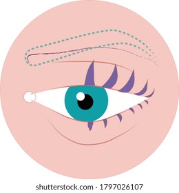 Eyebrows cosmetic procedure. Eyebrow implantation. 