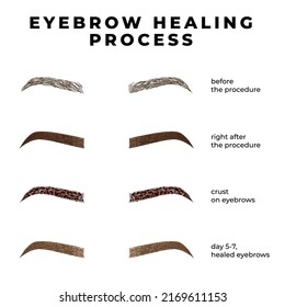 Eyebrows healing process after microblading. Healing stages eyebrows. 