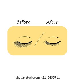 Eyelash extension. Improper eyelash extensions. Consequences of eyelash extensions. Harmful preparations for eyelashes.


