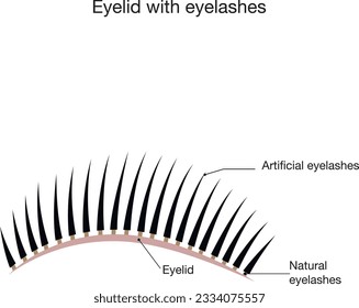 Eyelid with artificial eyelashes. Eyelash extension procedure scheme.