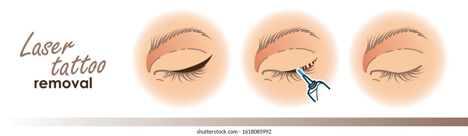 Eyeliner removal procedure illustration.Laser tattoo removal icons, microblading. For your design