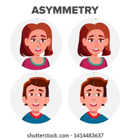 Eyes Asymmetry Of Character Man And Girl Vector. Young Boy Male And Woman Female Ptosis Eyelid Asymmetry. Before And After Operating Plastic Correction Surgery Flat Cartoon Illustration