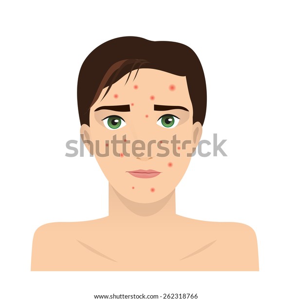 Face Acne Illustration Stock Vector (Royalty Free) 262318766