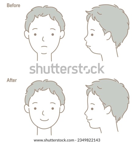 The face of a child with a small jaw and teeth, before and after orthodontic treatment