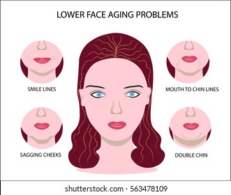 Face of a girl demonstrating lower face aging problems