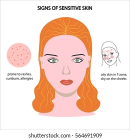 Face Girl Sensitive Skin Prone Rashes Stock Vector (Royalty Free ...