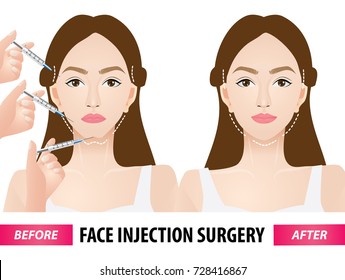 Face injection surgery before and after vector illustration