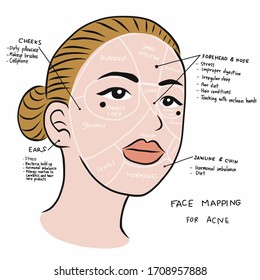 Face Mapping For Acne , Beautiful Woman Face Vector Illustration