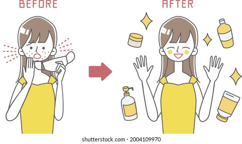 face mask Rough skin Sunburn illustration 