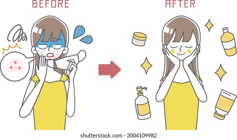 face mask Rough skin Sunburn illustration 