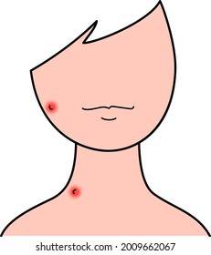 Face, neck, insect bite,itchy, swollen illustration material
