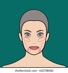 Face rejuvenation. Plastic surgery. Vector illustration.