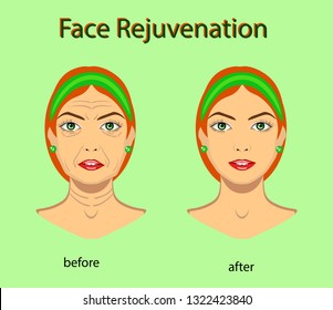Rejuvenecimiento de la cara, Ilustración vectorial con efecto antes y después