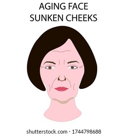 Face of woman with wrinkles and sunken cheeks