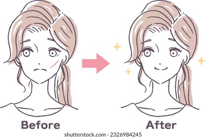 Face wound Disappearing treatment Before after Person woman Illustration material