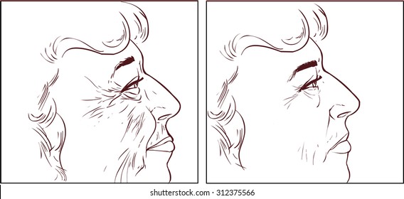 face wrinkles