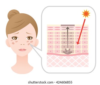 facial blotches and skin mechanism