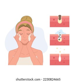 Facial care, skin defects, skin problems, acne, facials. Face Care woman concept. Step of remove acne. Vector illustration.