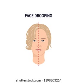 Facial Drooping Vector Concept Caucasian Woman Stock Vector (Royalty ...