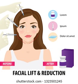 Facial lift and reduction before and after vector illustration