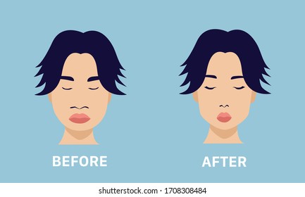 Facial lift and reduction before and after vector illustration.