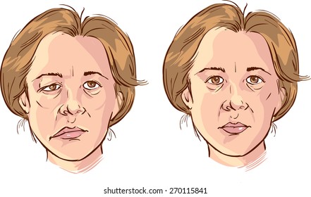 facial lopsided illustration