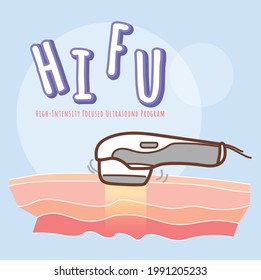 Facial Medical procedure vector of High-Intensity Focused Ultrasound Program (HIFU) for Anti-Aging.