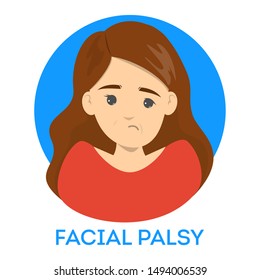 Facial Palsy. Female Character With Assymetrical Face, Nerve Damage. Drooping Smile. Isolated Vector Illustration In Cartoon Style