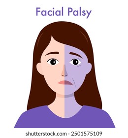 Facial palsy. Male character with asymmetrical face, nerve damage. Drooping smile.