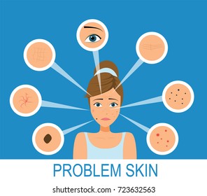 Skin Layer Diagram Images, Stock Photos & Vectors 