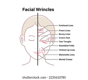 Facial wrinkles ( female face ) vector illustration