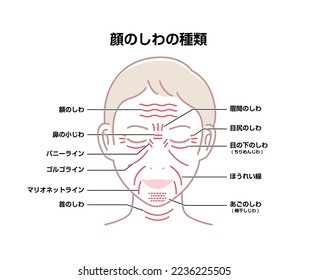 Facial wrinkles ( female face ) vector illustration| translation: forehead lines, crow's feet, bunny lines, marionette lines, neck wrinkles, frown lines, tear troughs, nasolabial folds, mental crease.