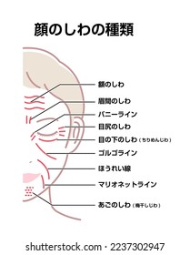 Facial wrinkles ( female face ) vector illustration| translation: forehead lines, crow's feet, bunny lines, marionette lines, neck wrinkles, frown lines, tear troughs, nasolabial folds, mental crease.