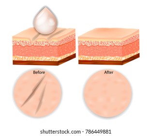 Facial wrinkles treatment before after. Facial treatment concept. Organic cosmetic and skin care cream. Vector illustration.Collagen and elastine. 