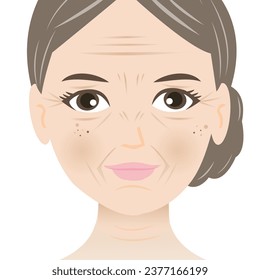 Facial wrinkles woman vector illustration isolated on white background. Forehead, Bunny, Marionette, Frown lines, Mental crease, Crows feet, Tear troughs, Nasolabial folds, Smile and Neck lines.