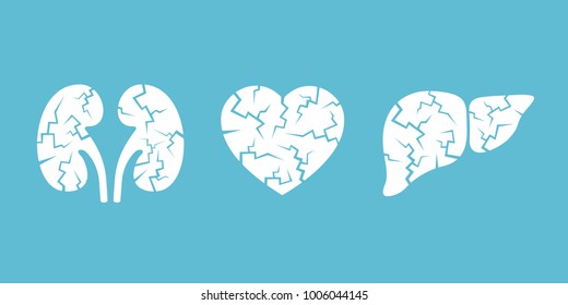 Failure And Desease Of Kidneys, Heart And Liver. Human Organ Is Deteriorated And Damaged. Vector Illustration