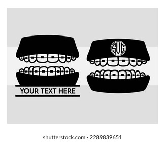 Fake Braces, Fake Braces Kit, Fake Braces Clip On, Dental Braces For Kids, Teeth Svg, Dentist, Dental Hygienist, Eps, Cut file