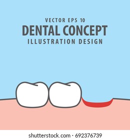 Fallen tooth illustration vector on blue background. Dental concept.